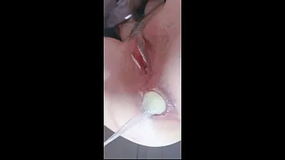 VLXX