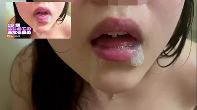 VLXX