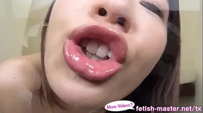 VLXX