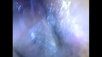 VLXX