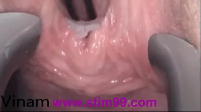 VLXX