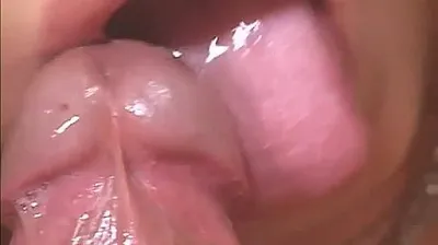 VLXX