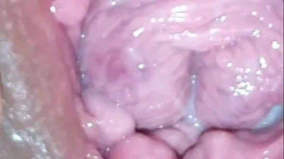 VLXX