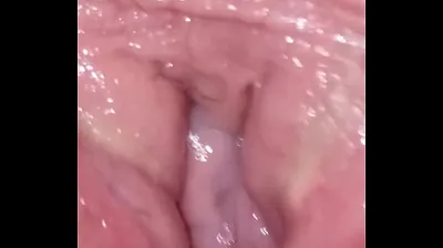 VLXX