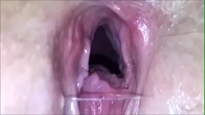 VLXX