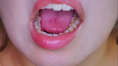 VLXX