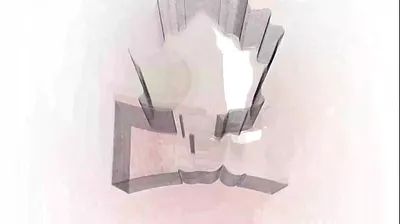 VLXX