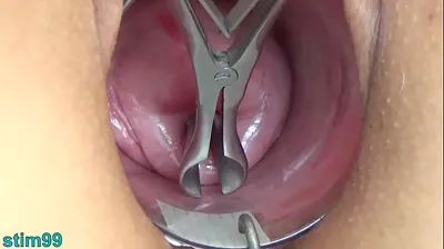 VLXX