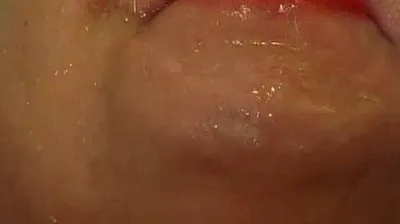 VLXX