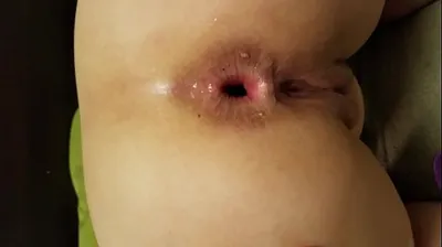 VLXX