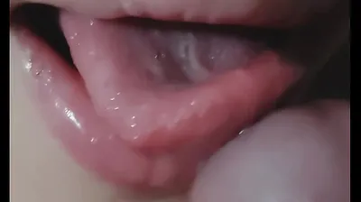 VLXX