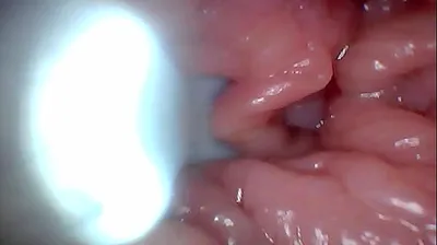VLXX