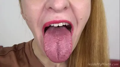 VLXX