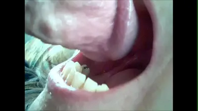 VLXX