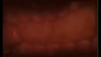 VLXX