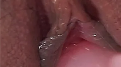 VLXX