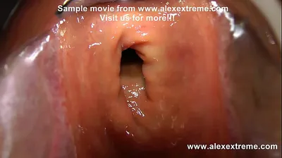 VLXX