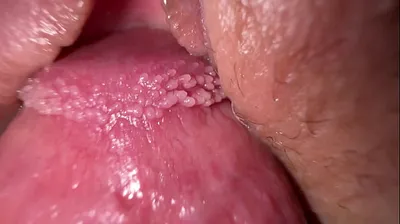 VLXX