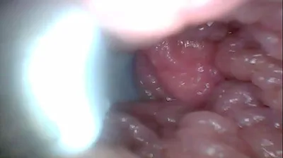 VLXX