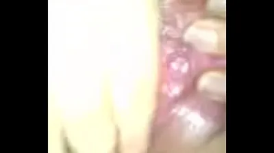 VLXX