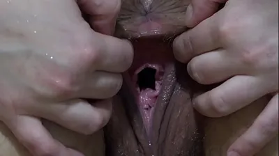 VLXX