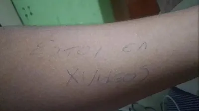 VLXX