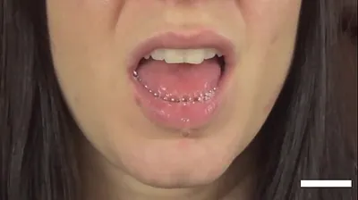 VLXX
