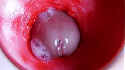 VLXX