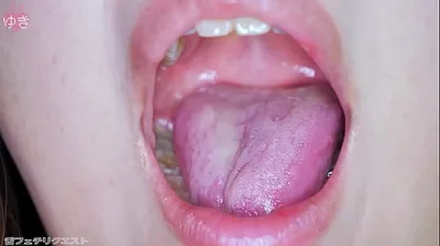 VLXX