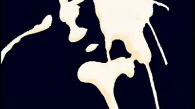 VLXX