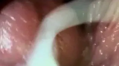 VLXX