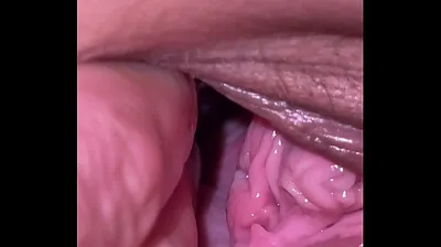 VLXX