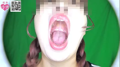 VLXX