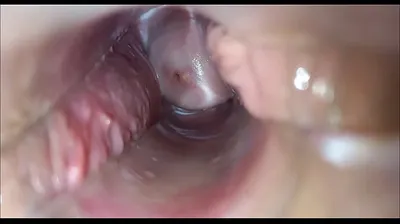 VLXX