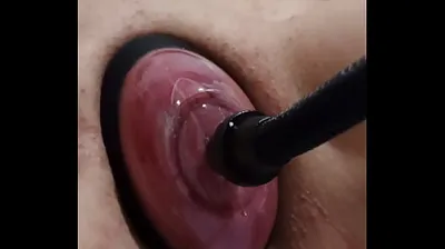 VLXX
