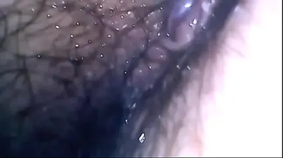 VLXX