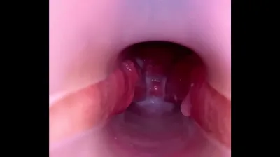 VLXX