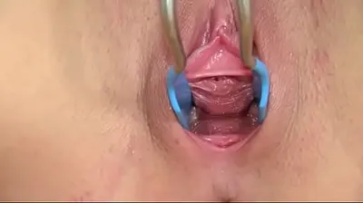 VLXX