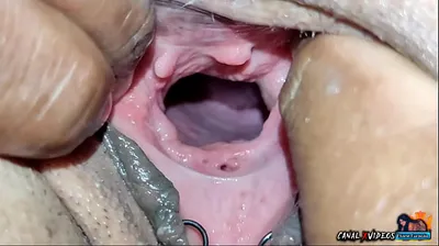 VLXX