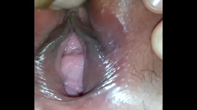 VLXX