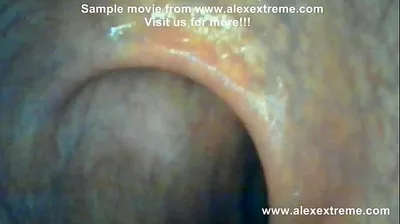 VLXX