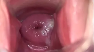 VLXX