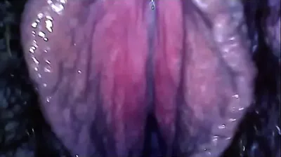 VLXX