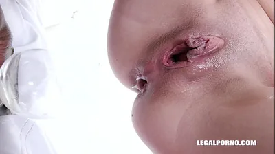 VLXX