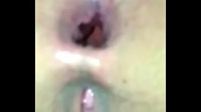 VLXX