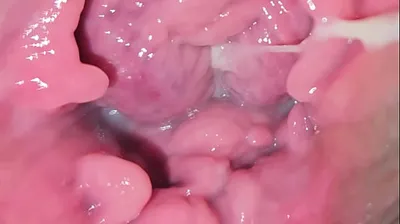 VLXX