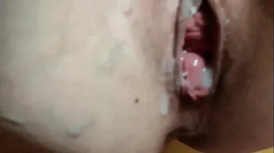 VLXX