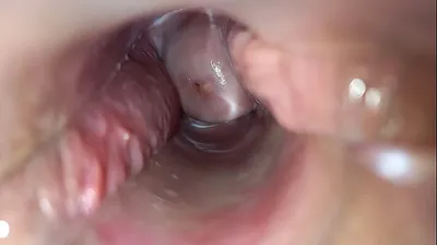 VLXX