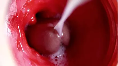 VLXX