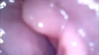 VLXX